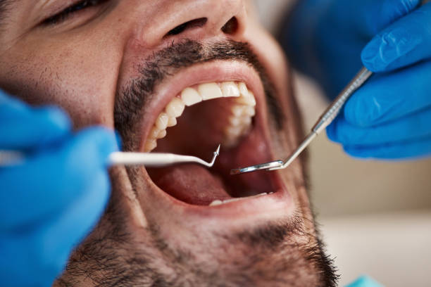 Best Urgent Dental Care in Poplar Cotton Center, CA