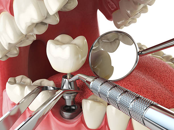 Best Weekend Emergency Dentist in Poplar Cotton Center, CA